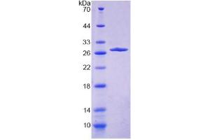 SDS-PAGE (SDS) image for Collagen, Type IV, alpha 4 (Col4A4) (AA 1469-1690) protein (His tag) (ABIN4989025) (Col4a4 Protein (AA 1469-1690) (His tag))