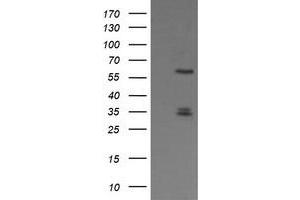 Image no. 1 for anti-Polo-Like Kinase 1 (PLK1) antibody (ABIN1500284) (PLK1 antibody)