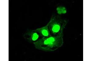 Image no. 1 for anti-DNA Fragmentation Factor, 45kDa, alpha Polypeptide (DFFA) antibody (ABIN1498772) (DFFA antibody)