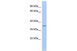 Calbindin 2 antibody used at 1 ug/ml to detect target protein. (Calretinin antibody  (N-Term))
