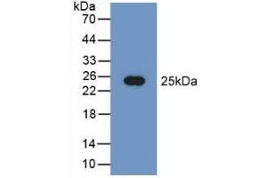 Detection of Recombinant PEBP1, Human using Polyclonal Antibody to Phosphatidylethanolamine Binding Protein 1 (PEBP1) (PEBP1 antibody  (AA 2-187))