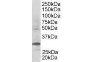 Image no. 2 for anti-F-Box and WD Repeat Domain Containing 2 (FBXW2) (C-Term) antibody (ABIN374352) (FBXW2 antibody  (C-Term))