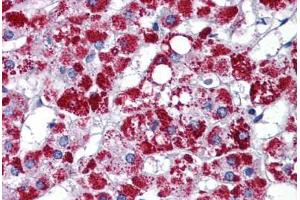 Human Adrenal: Formalin-Fixed, Paraffin-Embedded (FFPE) (ARL8A antibody  (AA 72-121))