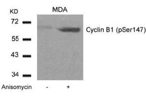 Image no. 3 for anti-Cyclin B1 (CCNB1) (pSer147) antibody (ABIN401594) (Cyclin B1 antibody  (pSer147))