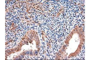 Image no. 3 for anti-Myc Proto-Oncogene protein (MYC) antibody (ABIN1497012) (c-MYC antibody)