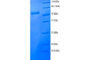 Proteasome (Prosome, Macropain) Activator Subunit 2 (PA28 Beta) (PSME2) (AA 2-239), (full length) protein (GST tag)