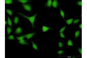 Immunofluorescence of purified MaxPab antibody to DPF2 on HeLa cell. (DPF2 antibody  (AA 1-391))