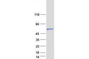 Validation with Western Blot (CLNK Protein (Myc-DYKDDDDK Tag))