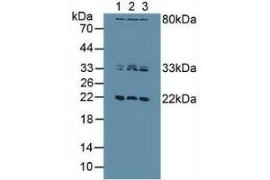 Western blot analysis of (1) Human HeLa cells, (2) Human Jurkat Cells and (3) Human MCF7 Cells.
