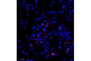 Immunofluorescence (Paraffin-embedded Sections) (IF (p)) image for anti-Transducin-Like Enhancer of Split 1 (E(sp1) Homolog, Drosophila) (TLE1) antibody (ABIN7075961)