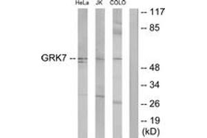 Western blot analysis of extracts from COLO205/Jurkat/HeLa cells, using GRK7 Antibody. (GRK7 antibody  (AA 371-420))