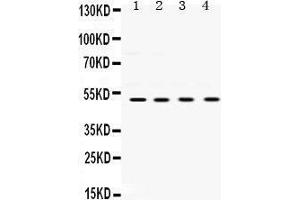 Western Blotting (WB) image for anti-Ubiquitin-Conjugating Enzyme E2Q Family Member 2 (UBE2Q2) (AA 83-123), (N-Term) antibody (ABIN3043953) (UBE2Q2 antibody  (N-Term))