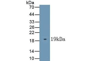 Detection of Recombinant KISS1, Human using Polyclonal Antibody to Kisspeptin 1 (KISS1) (KISS1 antibody  (AA 20-138))