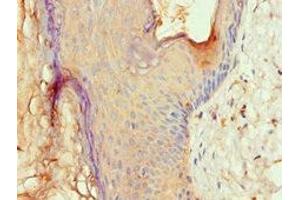 Immunohistochemistry of paraffin-embedded human skin tissue using ABIN7144532 at dilution of 1:100 (ALOX15B antibody  (AA 1-200))