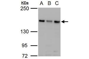 ROCK2 antibody