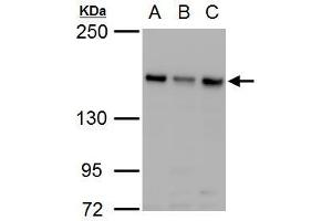 WB Image ROCK2 antibody detects ROCK2 protein by western blot analysis.
