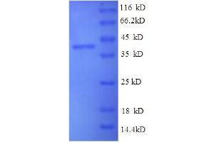 SDS-PAGE (SDS) image for Synuclein, alpha (SNCA) (AA 1-140), (full length) protein (His tag) (ABIN5710386)