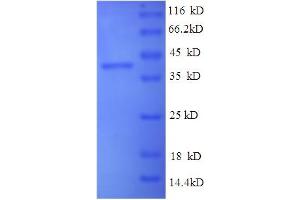 SDS-PAGE (SDS) image for Synuclein, alpha (SNCA) (AA 1-140), (full length) protein (His tag) (ABIN5710386)