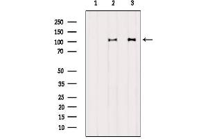 Western blot analysis of extracts from various samples, using DDX58  Antibody. (DDX58 antibody  (N-Term))