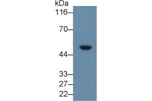 Detection of LRG1 in Human Serum using Monoclonal Antibody to Leucine Rich Alpha-2-Glycoprotein 1 (LRG1) (LRG1 antibody  (AA 37-340))