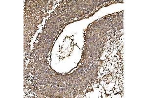 IHC analysis of PARK7/DJ1 using anti-PARK7/DJ1 antibody (ABIN7600468). (PARK7/DJ1 antibody  (AA 2-189))