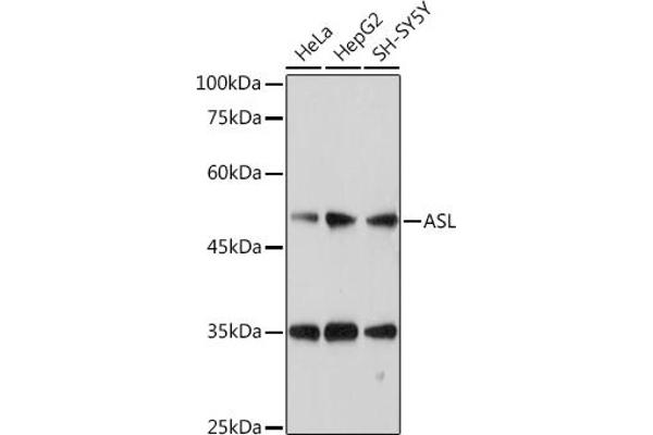 ASL antibody  (AA 1-300)