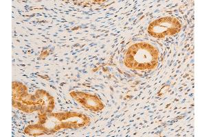 Immunohistochemistry (IHC) image for anti-Forkhead Box O3 (FOXO3) (pSer253) antibody (ABIN6255131)