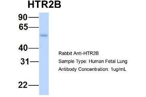 Host:  Rabbit  Target Name:  HTR2B  Sample Type:  Human Fetal Lung  Antibody Dilution:  1. (Serotonin Receptor 2B antibody  (N-Term))