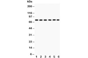 Western blot testing of PKC delta antibody and Lane 1:  HeLa (PKC delta antibody  (AA 1-160))