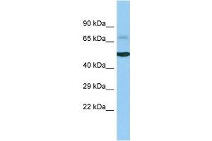 Host: Rabbit Target Name: ACOXL Sample Type: Fetal Liver lysates Antibody Dilution: 1. (ACOXL antibody  (C-Term))