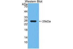 Western blot analysis of the recombinant protein. (Growth Hormone 1 antibody  (AA 28-216))
