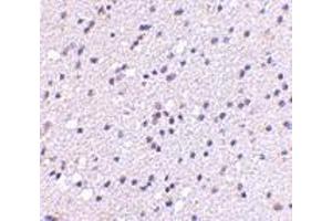 Immunohistochemistry of CAPS2 in human brain with CAPS2 antibody at 5 μg/ml. (CADPS2 antibody  (Center))