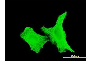 Immunofluorescence of monoclonal antibody to TUBA4A on HeLa cell. (TUBA4A antibody  (AA 1-448))