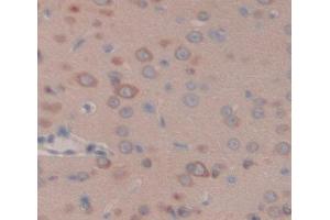 Used in DAB staining on fromalin fixed paraffin- embedded brain tissue (GLRa2 antibody  (AA 28-253))