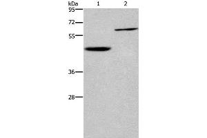 Western Blot analysis of Human hepatocellular carcinoma tissue and Jurkat cell using DOK1 Polyclonal Antibody at dilution of 1:450 (DOK1 antibody)