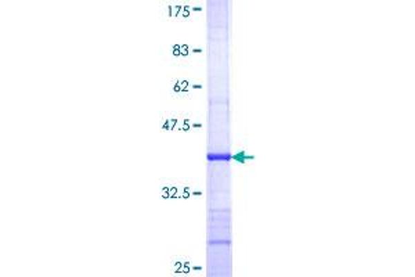 ADCY3 Protein (AA 1035-1144) (GST tag)