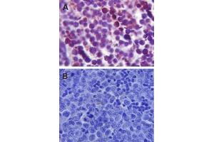 Immunohistochemistry analysis using Rabbit Anti-TLR4 Polyclonal Antibody . (TLR4 antibody  (AA 420-435) (APC))