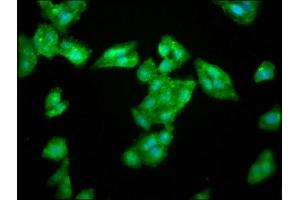 Immunofluorescence staining of HepG2 cells with ABIN7168164 at 1:266, counter-stained with DAPI. (LAS1L antibody  (AA 490-565))