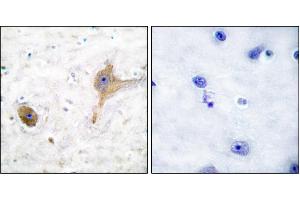 Immunohistochemical analysis of paraffin-embedded human brain tissue using GABA B Receptor antibody. (GABA B Receptor antibody)