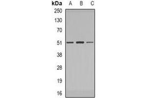 Western blot analysis of IRAK4 expression in MCF7 (A), Jurkat (B), Raji (C) whole cell lysates. (IRAK4 antibody)