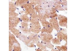 IHC analysis of FFPE human skeletal muscle section using SDHA antibody; Ab was diluted at 1:25. (SDHA antibody  (AA 577-605))