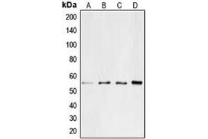 Western blot analysis of CD4 expression in Jurkat (A), SP2/0 (B), PC12 (C), H9C2 (D) whole cell lysates.