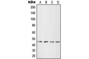 Western blot analysis of LHX1 expression in HEK293T (A), HepG2 (B), SP2/0 (C), H9C2 (D) whole cell lysates. (LHX1 antibody  (Center))