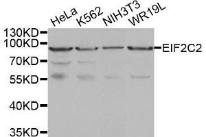 Western Blotting (WB) image for anti-Argonaute 2 (AGO2) antibody (ABIN1877052) (AGO2 antibody)