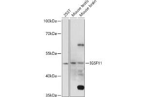 Western blot analysis of extracts of various cell lines, using IGSF11 antibody (ABIN7267849) at 1:1000 dilution. (IGSF11 antibody  (AA 80-200))