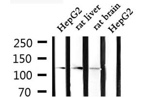 Western blot analysis of extracts from HepG2, rat liver and rat brain, using CLIP2 Antibody.