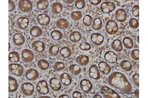 Image no. 1 for anti-N-Deacetylase/N-Sulfotransferase (Heparan Glucosaminyl) 1 (NDST1) (AA 38-137) antibody (ABIN598755) (NDST1 antibody  (AA 38-137))