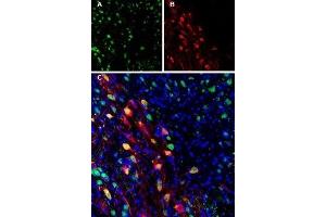 Expression of Ferroportin in mouse brainImmunohistochemical staining of perfusion-fixed frozen mouse substantia nigra pars compacta (SNC) sections using Anti-Ferroportin (SLC40A1) Antibody (ABIN7043729, ABIN7044546 and ABIN7044547). (Solute Carrier Family 40 (Iron-Regulated Transporter), Member 1 (SLC40A1) Peptide)