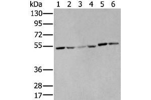 Western Blotting (WB) image for anti-Matrix Metallopeptidase 1 (Interstitial Collagenase) (MMP1) antibody (ABIN2427602) (MMP1 antibody)