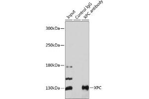 Immunoprecipitation analysis of 200 μg extracts of 293T cells using 3 μg XPC antibody ( ABIN6128932, ABIN6150295, ABIN6150296 and ABIN6224381). (XPC antibody  (AA 700-940))